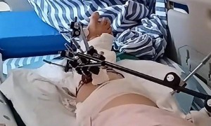江西一女子从12楼不慎坠落奇迹生还，当事人讲述更多细节